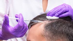 PRP Treatment
